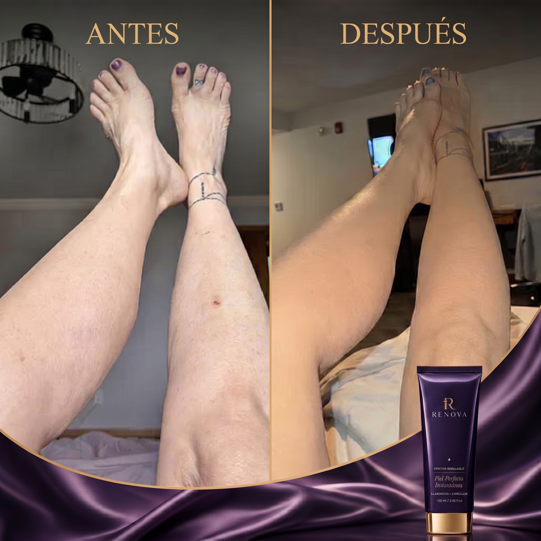 Renova® Piel Perfecta Instantánea