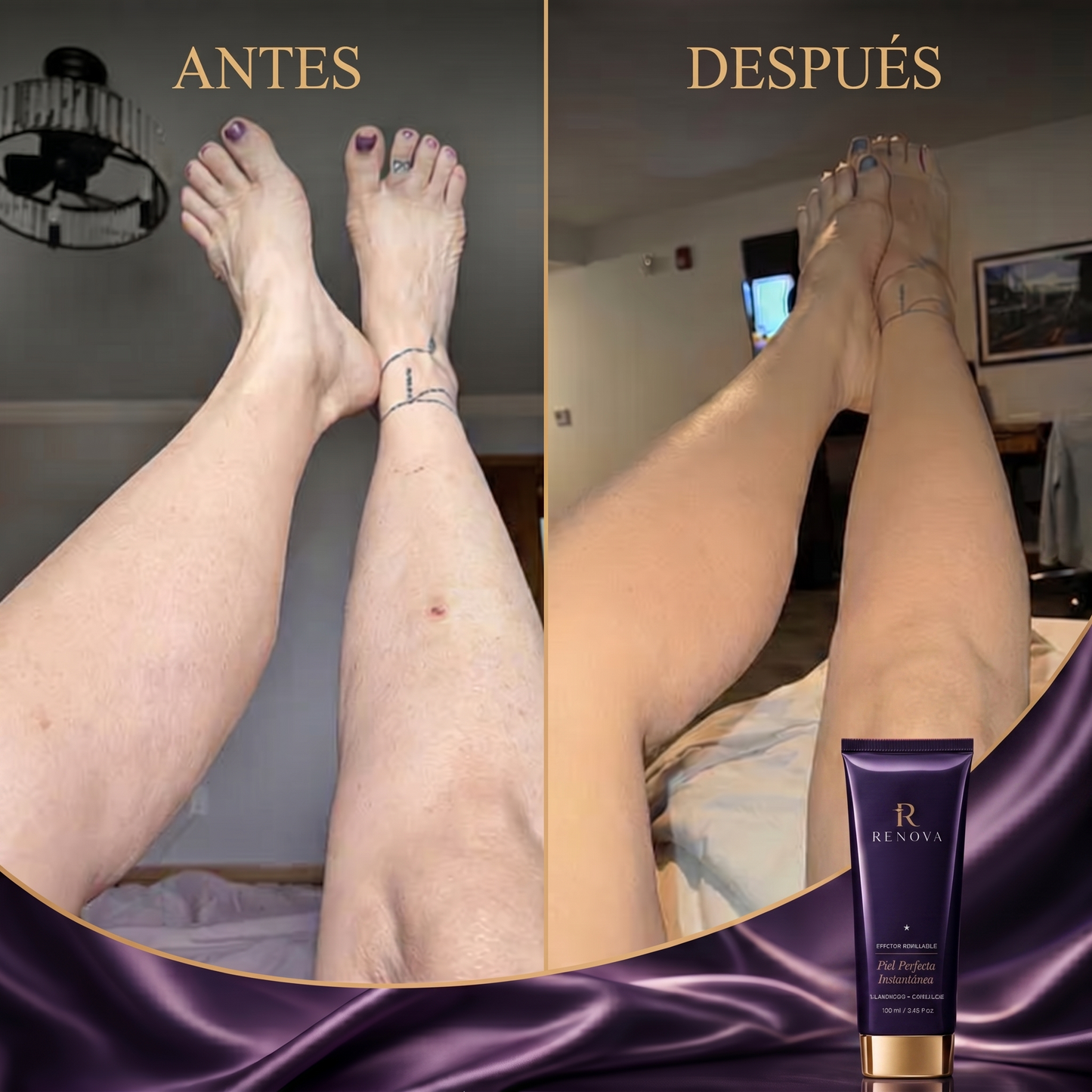 Renova® Piel Perfecta Instantánea