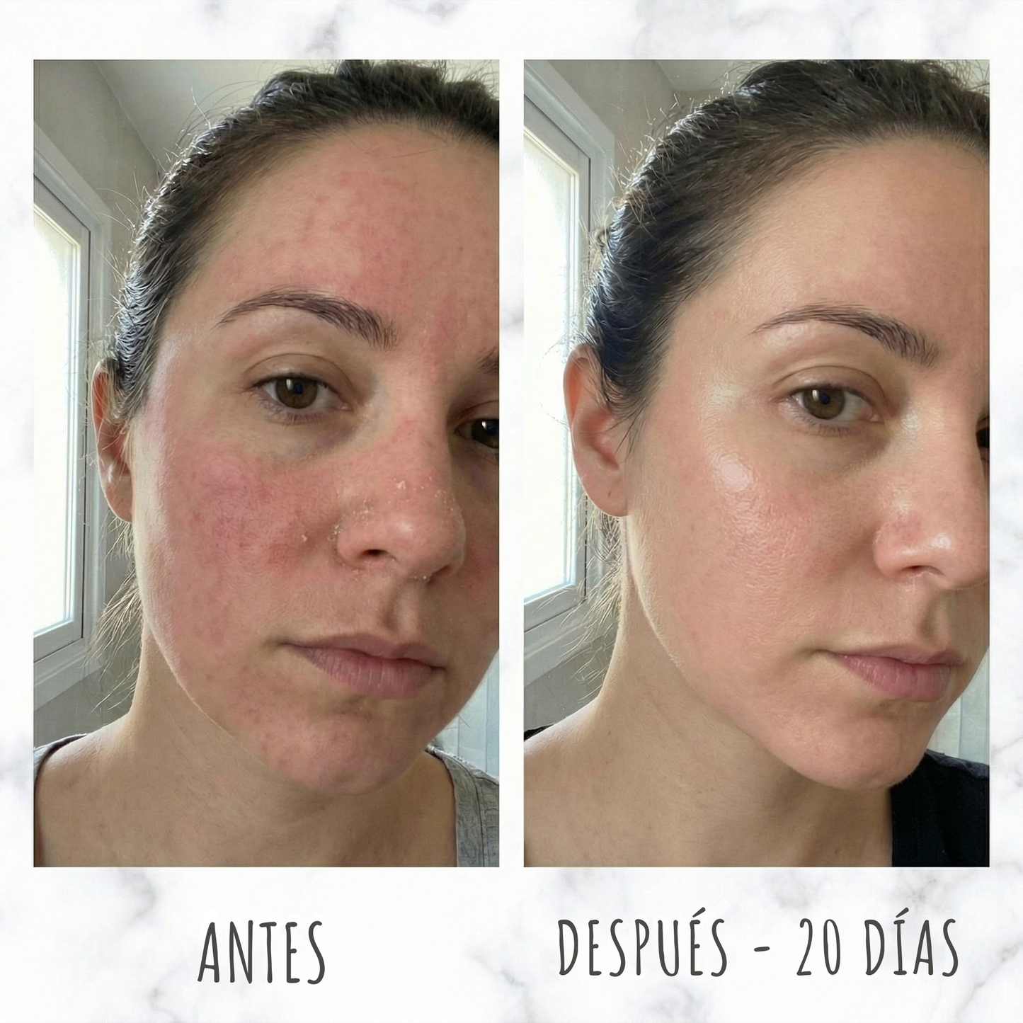 Renova® Piel Renovada