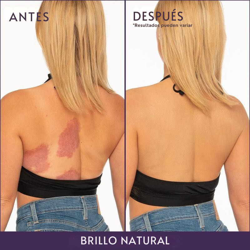 Renova® Piel Perfecta Instantánea