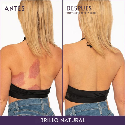 Renova® Piel Perfecta Instantánea