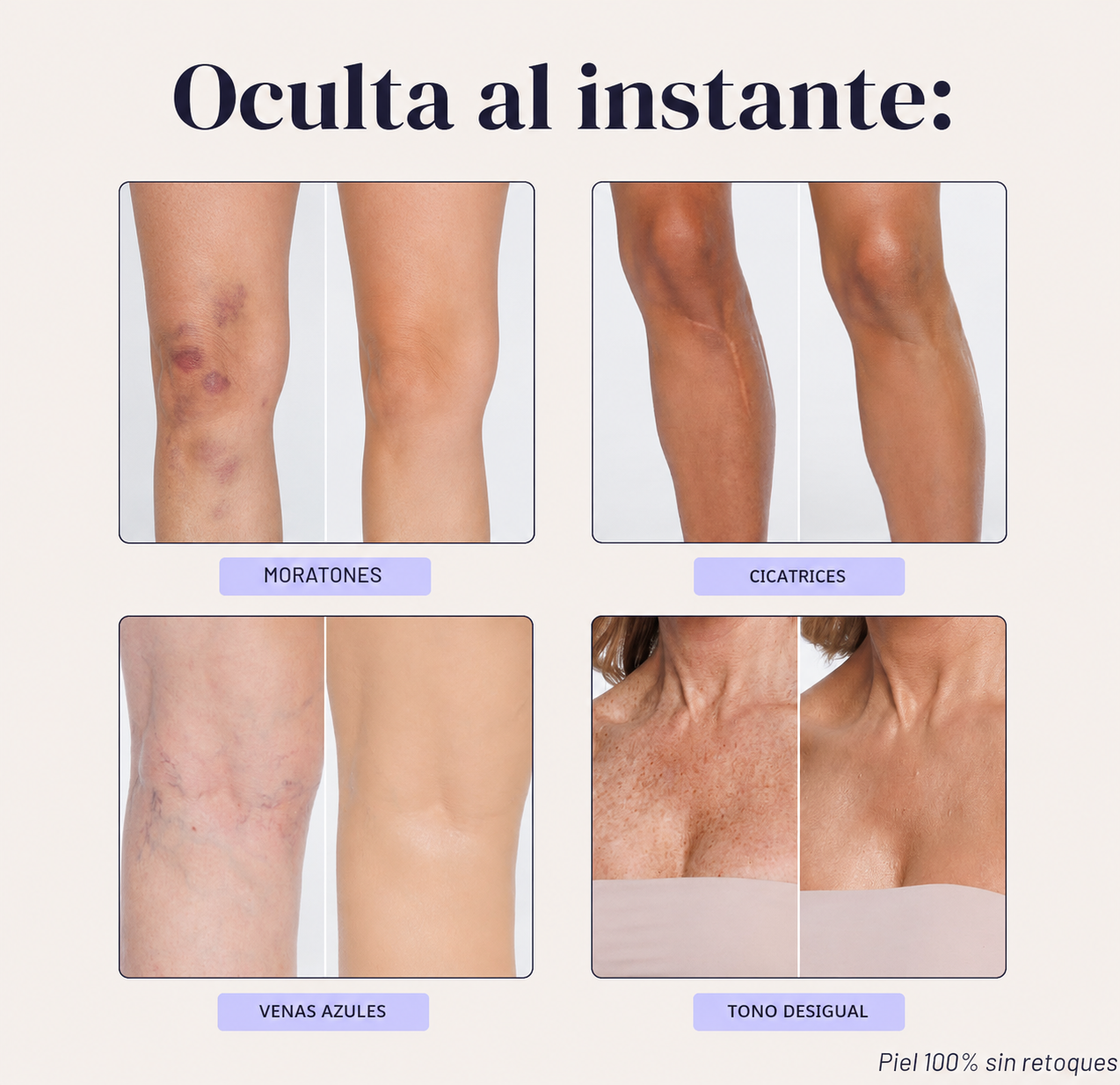 Renova® Piel Perfecta Instantánea