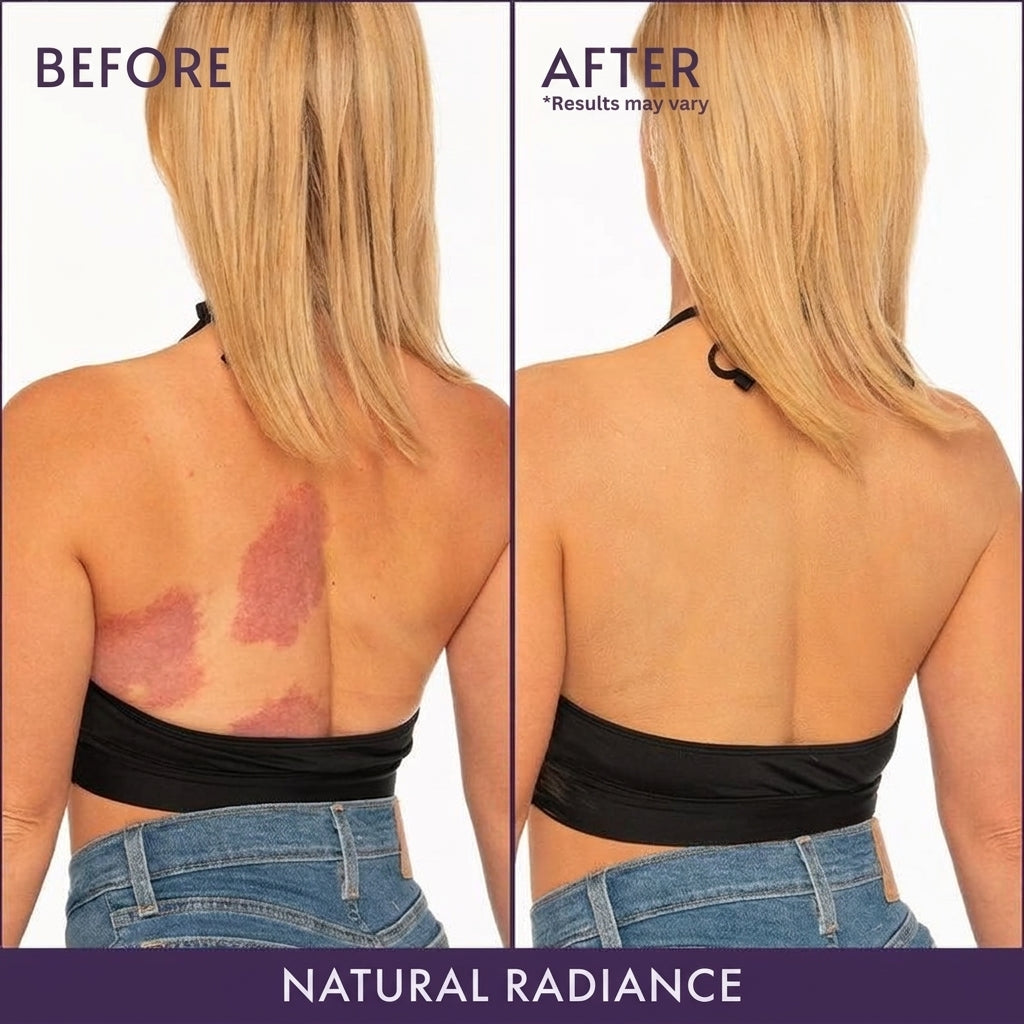 Renova® Instant Perfect Skin